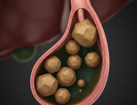 پتّے میں پتھری نہیں بلکہ جما ہوا صفرا ہوتا ہے